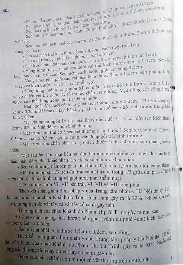 Xử vụ bé trai bị bố đẻ, mẹ kế hành hạ: Rùng mình nghe cáo trạng-4