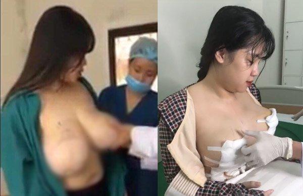 Hotgirl Hải Dương xuất hiện sau khi cắt bỏ 60% thể tích ngực-3