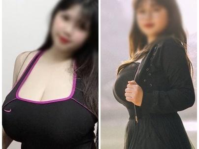 Hotgirl Hải Dương xuất hiện sau khi cắt bỏ 60% thể tích ngực