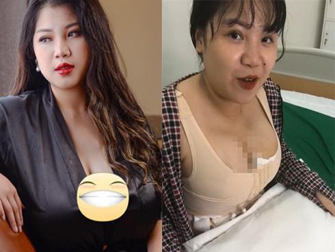 Vừa rút 2 lít mỡ từ ngực chưa đầy 1 tuần, nữ sinh Hải Dương tiếp tục hút thêm 6 lít mỡ bụng và đùi-4