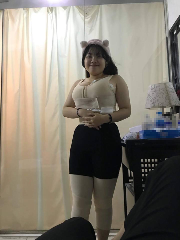 CÓ AI NGỜ: Nữ sinh Hải Dương gọn gàng khó tin sau cuộc đại phẫu rút 9 lít mỡ thừa ở ngực và bụng-2