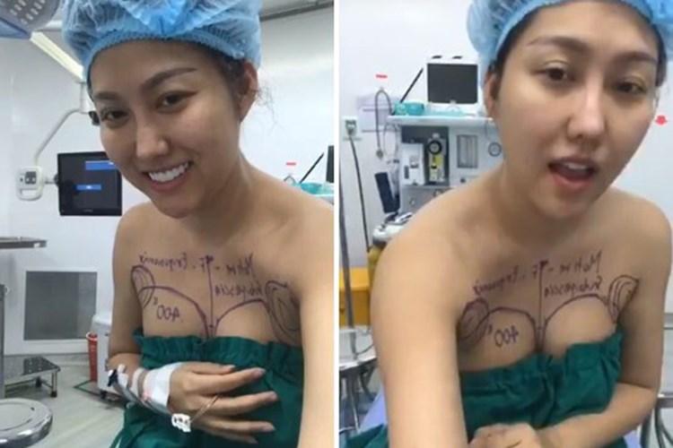 Những hình ảnh vẽ tạo hình, băng bó chằng chịt của sao Việt trên bàn phẫu thuật thẩm mỹ khiến người ta giật mình-11