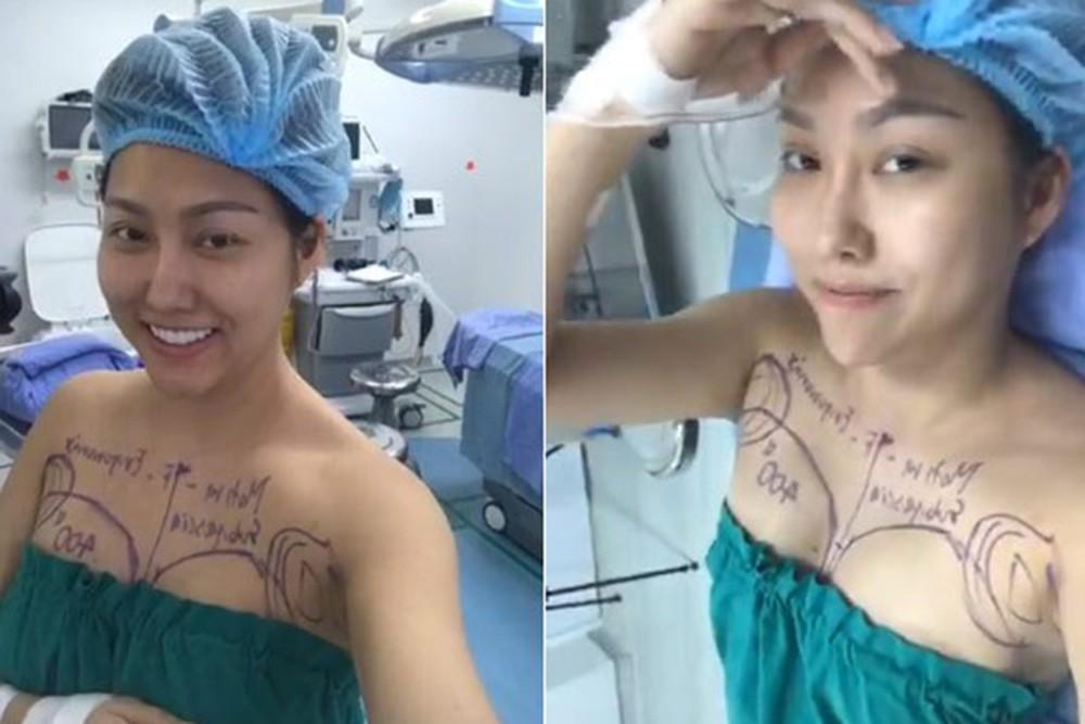 Những hình ảnh vẽ tạo hình, băng bó chằng chịt của sao Việt trên bàn phẫu thuật thẩm mỹ khiến người ta giật mình-12