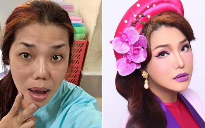 Những hình ảnh vẽ tạo hình, băng bó chằng chịt của sao Việt trên bàn phẫu thuật thẩm mỹ khiến người ta giật mình-13