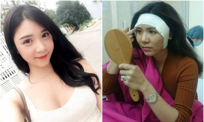 Những hình ảnh vẽ tạo hình, băng bó chằng chịt của sao Việt trên bàn phẫu thuật thẩm mỹ khiến người ta giật mình-22