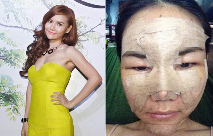 Những hình ảnh vẽ tạo hình, băng bó chằng chịt của sao Việt trên bàn phẫu thuật thẩm mỹ khiến người ta giật mình-23