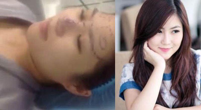 Những hình ảnh vẽ tạo hình, băng bó chằng chịt của sao Việt trên bàn phẫu thuật thẩm mỹ khiến người ta giật mình-18