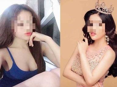 Thế giới showbiz và 'mảng tối không tên'