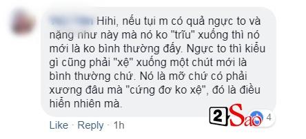 Dân mạng trưng hàng loạt bằng chứng chắc chắn Chi Pu đã phẫu thuật vòng 1 từ chanh thành bưởi-3