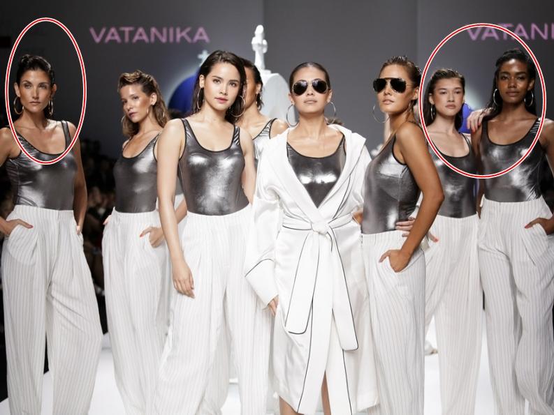 Người mẫu chống nạng, mẫu béo gây chú ý ở New York Fashion Week-3