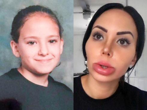 Vòng 1 đầy đặn bất thường, Vân Hugo dính nghi án phẫu thuật thẩm mỹ-13