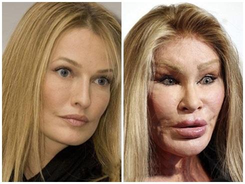 Nữ tỷ phú nghiện thẩm mỹ để chiều chồng và cái kết đắng