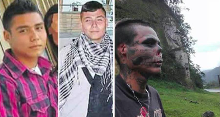 Thanh niên phá nát khuôn mặt vì mê hình tượng đầu lâu-1