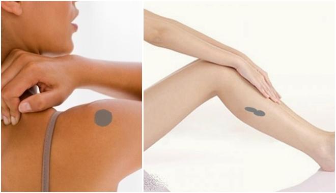 Bạn có vết bớt trên cơ thể không, nếu có thì cùng xem nó báo hiệu điều gì về tương lai của bạn nhé-1