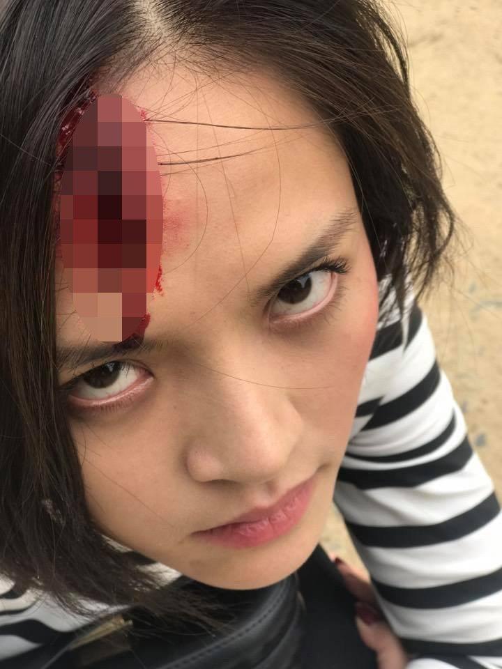 Lộ clip My Sói bị đánh dã man đến vỡ đầu chảy máu trong Quỳnh Búp Bê-4