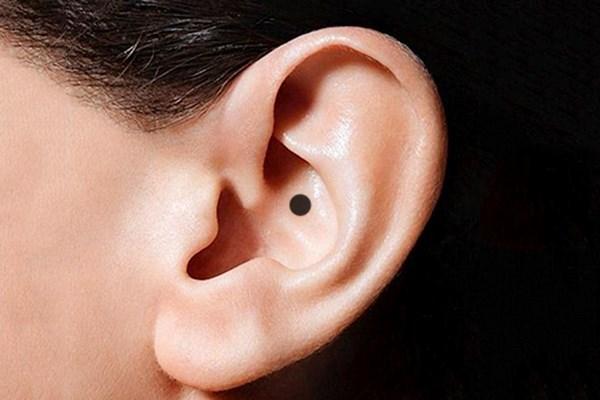 Nốt ruồi ở tai, vận đen hay may mắn, bạn cùng xem nó ở vị trí nào nhé-2