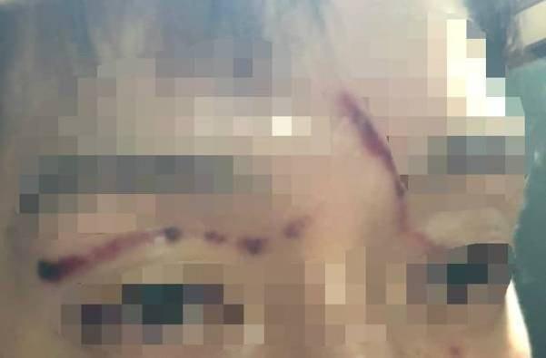 Búp bê xứ Hàn Goo Hara tung bằng chứng bị bạn trai đánh bầm dập vùng kín-8