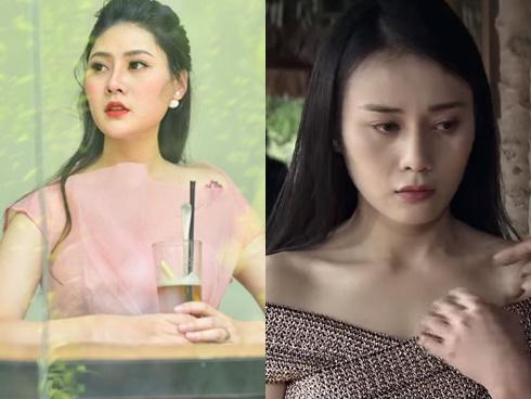 Em gái Lan Cave khẳng định đẹp tự nhiên nhưng không phải tự nhiên mà đẹp khi đã nhờ cậy filler-5