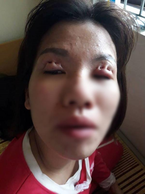 10 ca thẩm mỹ lợn lành thành lợn què vừa rùng mình vừa hài hước-1