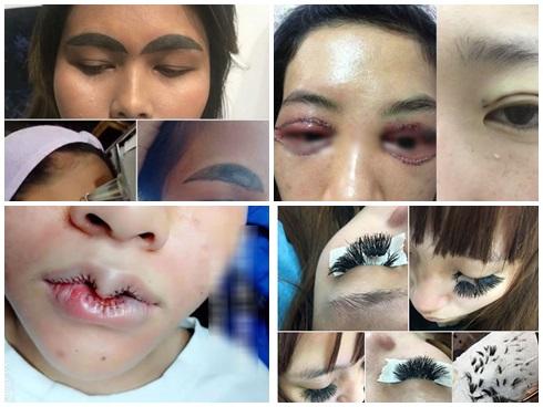 10 ca thẩm mỹ 'lợn lành thành lợn què' vừa rùng mình vừa hài hước