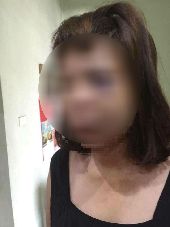 Kinh hoàng chồng bắt vợ lên đồi vắng đánh đập dã man rồi dùng dao cắt gân chân-1