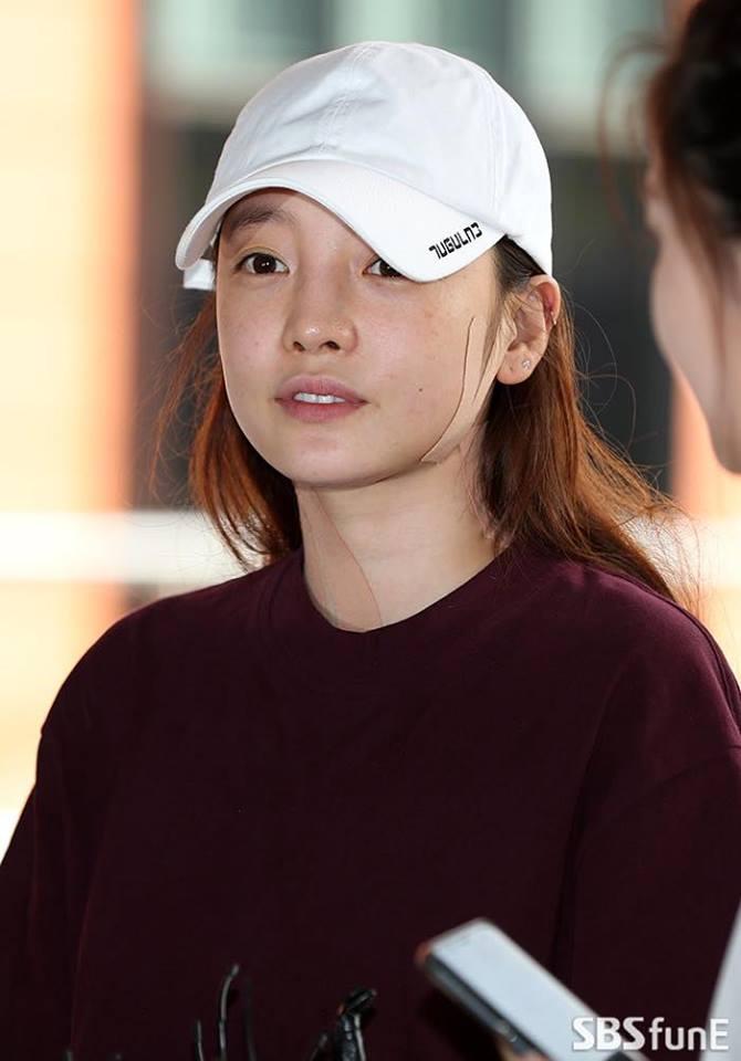 Búp bê xứ Hàn Goo Hara xuất hiện với khuôn mặt đầy thương tích, tay tím bầm vì bị bạn trai bạo hành-8