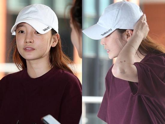 'Búp bê xứ Hàn' Goo Hara xuất hiện với khuôn mặt đầy thương tích, tay tím bầm vì bị bạn trai bạo hành