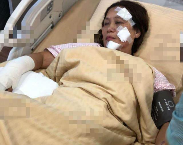 Nữ hoàng kungfu bị bỏng nặng vì hỏa hoạn trên trường quay-1