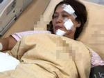 Hà Nội: Con rể đốt nhà bố vợ trong đêm khiến cháu bé 6 tuổi bỏng nặng-3