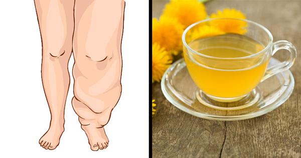 10 thực phẩm giúp giảm tích nước, hỗ trợ giảm cân nhanh-10