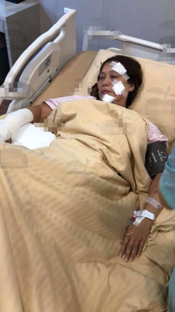 Cận cảnh vụ cháy phim trường khiến sao Anh hùng xạ điêu bị bỏng nặng-3