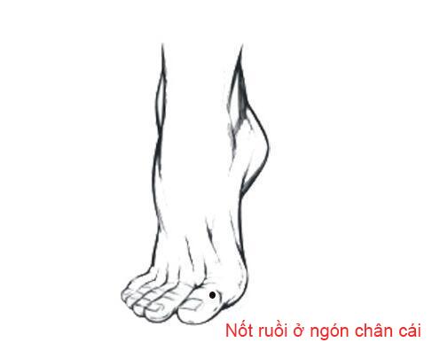 Nốt ruồi trên bàn chân nói lên điều gì?-2