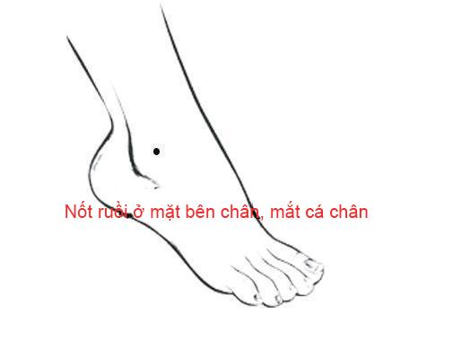 Nốt ruồi trên bàn chân nói lên điều gì?-5