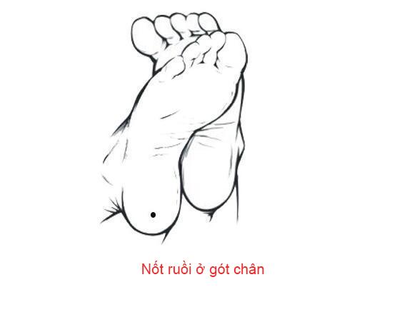 Nốt ruồi trên bàn chân nói lên điều gì?-6