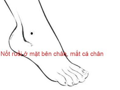 Nốt ruồi trên bàn chân nói lên điều gì?