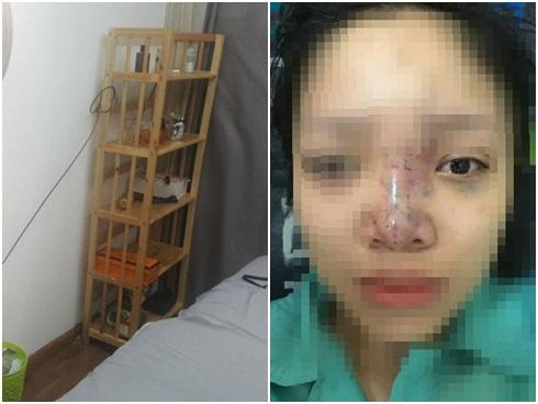 Sau chuyến du lịch cùng gia đình, cô gái 15 tuổi bị mù mắt bí ẩn-4