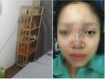 Nữ sinh bị mù mắt khi tiêm filler: Dấu hiệu đáng ngờ bên trong spa