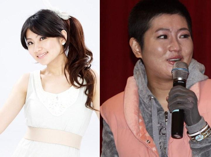 Sau 8 năm bị bỏng nặng, Selina (nhóm S.H.E) đẹp như mơ ở tuổi 36-2