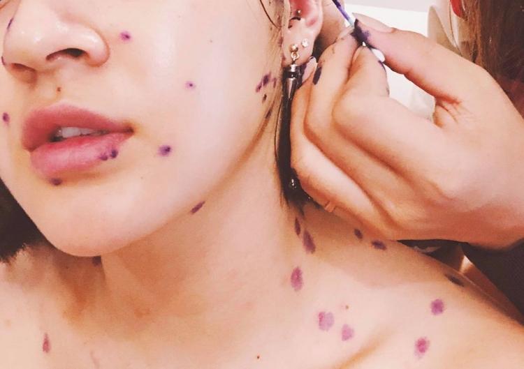 Trầm cảm - ho không ngớt - dị ứng khắp người: Những lần hoãn show thương không kể hết từ nghệ sĩ Việt-8