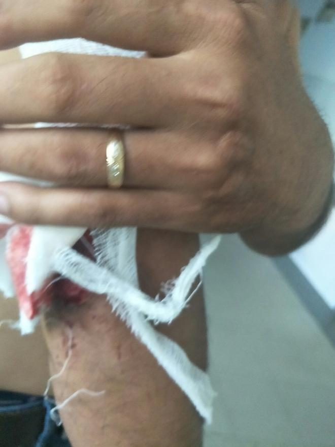 Chém trọng thương hai cha con hàng xóm vì tranh đất mồ mả-1