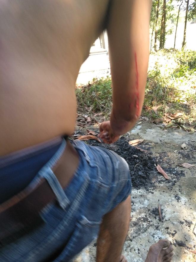 Chém trọng thương hai cha con hàng xóm vì tranh đất mồ mả-3