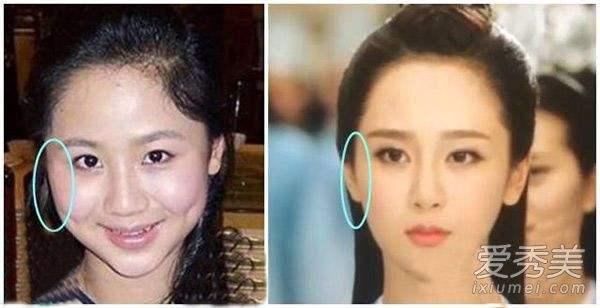 Tiểu hoa đán Dương Tử dính nghi án phẫu thuật thẩm mỹ-5