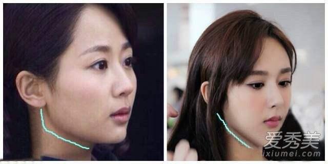 Tiểu hoa đán Dương Tử dính nghi án phẫu thuật thẩm mỹ-7