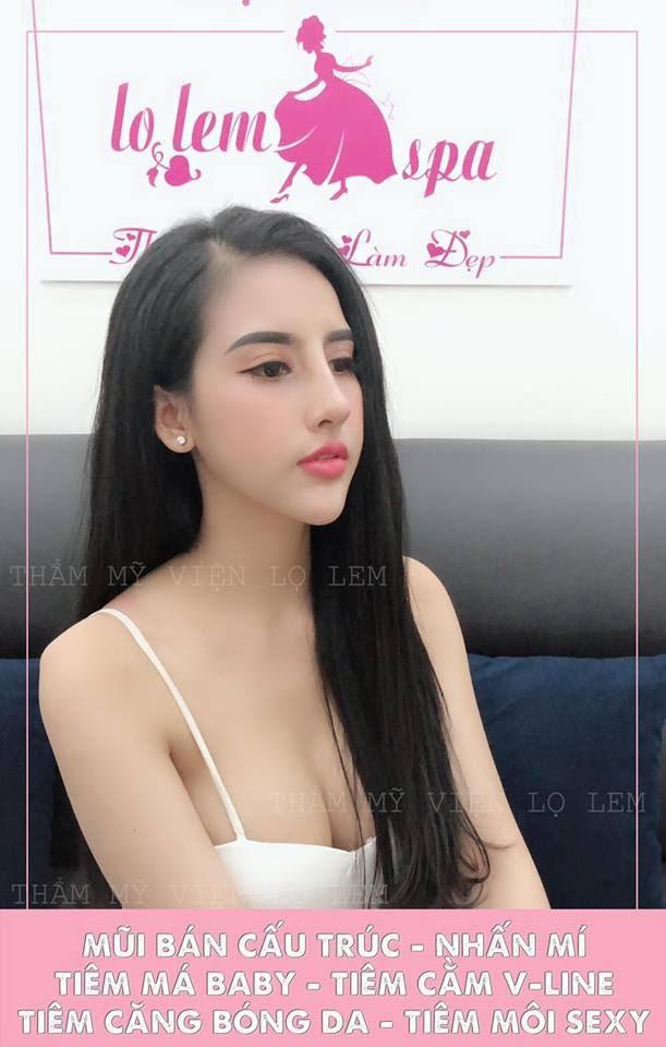 Hot girl Tiên Lê: Hóa ‘thiên nga’ nhờ phẫu thuật thẩm mỹ-3