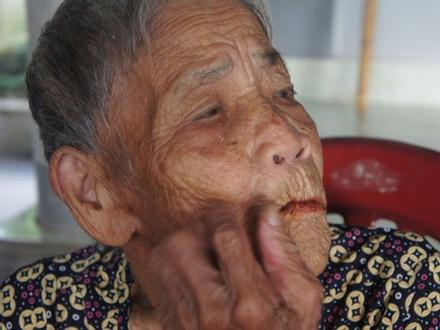 Hà Tĩnh:  Xôn xao câu chuyện cụ bà 98 tuổi mọc răng