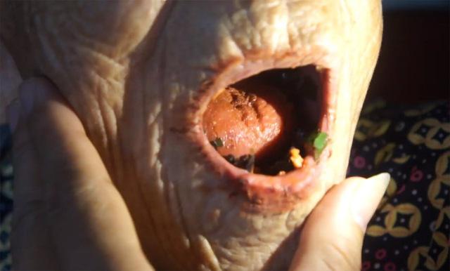 Hà Tĩnh: Xôn xao câu chuyện cụ bà 98 tuổi mọc răng-2