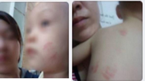 Hà Tĩnh: Xôn xao câu chuyện cụ bà 98 tuổi mọc răng-3