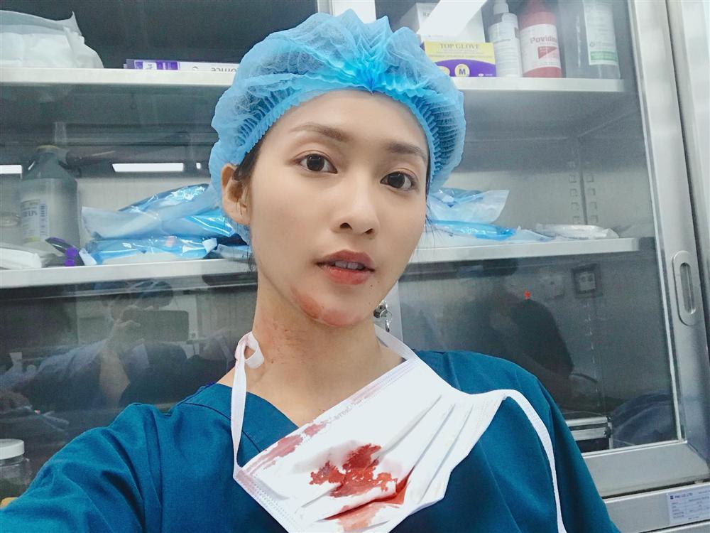 Máu me đầy người, Khả Ngân vẫn tự tin khoe trọn vẻ đẹp của bác sĩ Hoài Phương trong Hậu duệ mặt trời-1