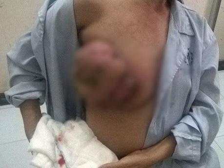 Cô gái thành đạt qua đời ở tuổi 33 chỉ vì chủ quan với chứng táo bón-5