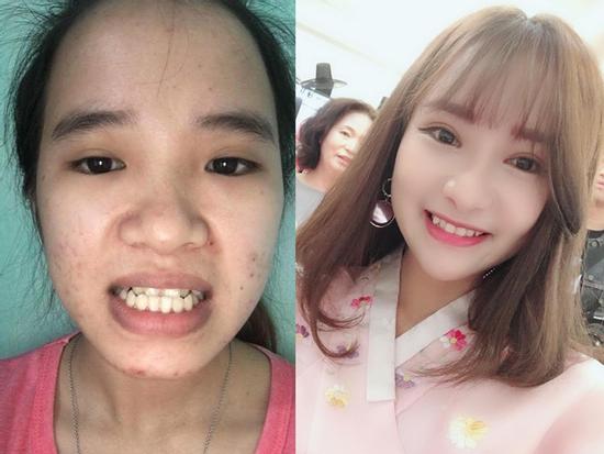 'Xinh như mộng' sau thẩm mỹ, cô gái Quảng Nam dám tỏ tình với crush